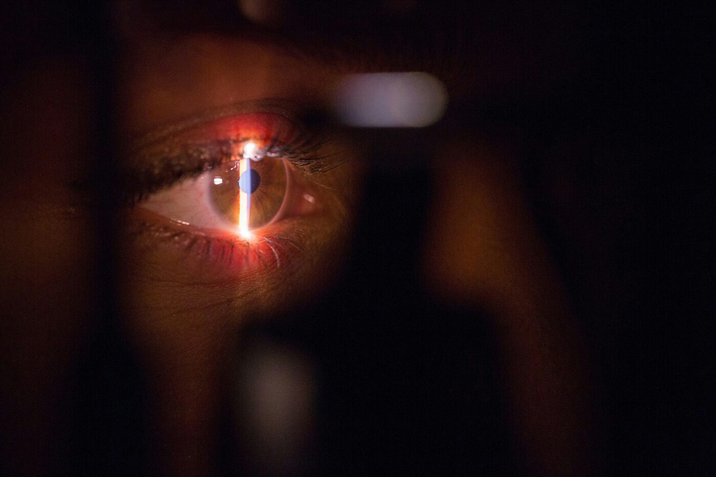 Close-up slit lamp eye health examination during a comprehensive eye exam with Dr. Roxanna Gangi, Optometrist in York Region