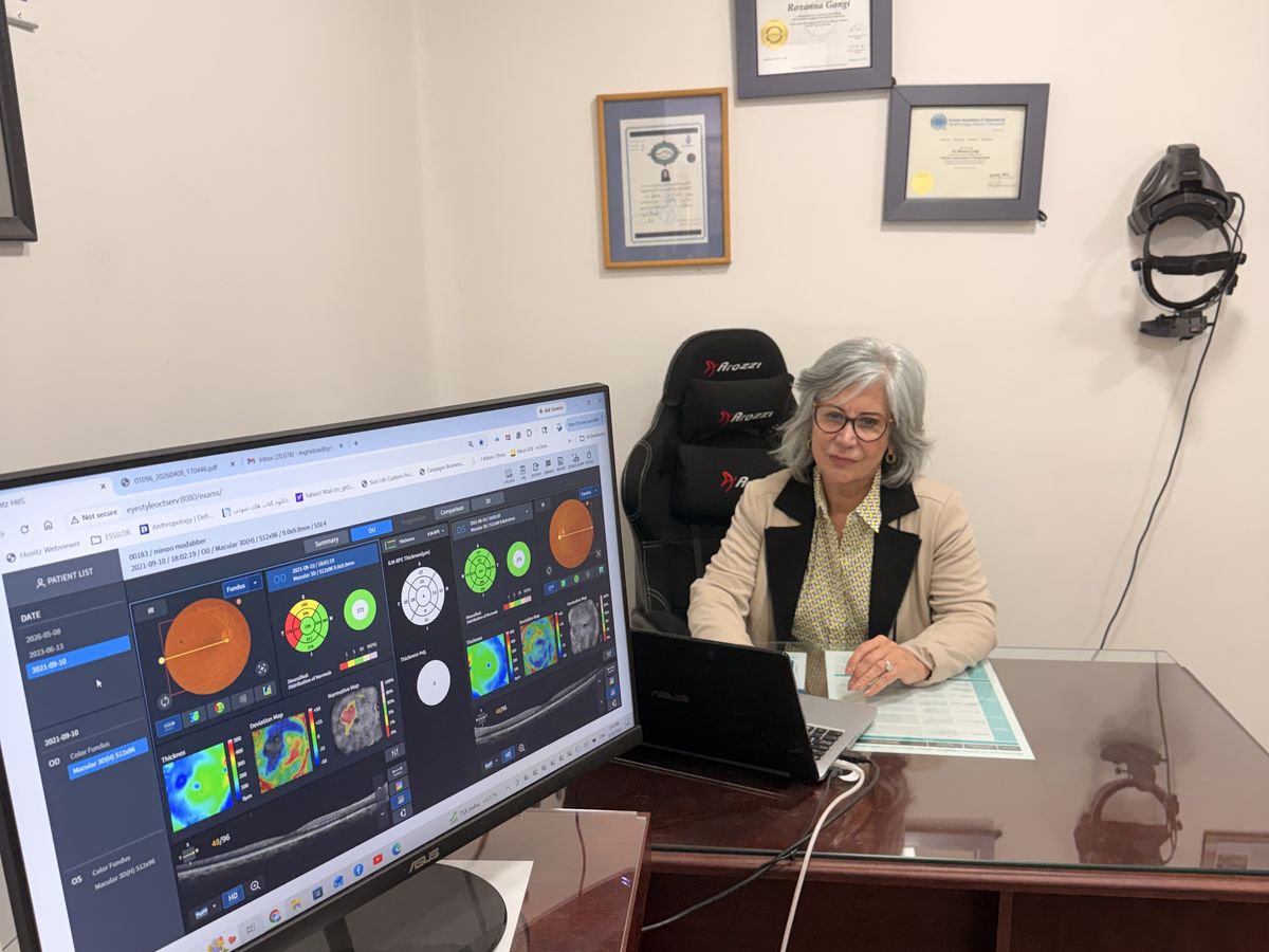 Dr. Roxanna Gangi reviewing OCT optic nerve and macular thickness scans for glaucoma monitoring and surgical co-management at Pro Eye Exam in York Region